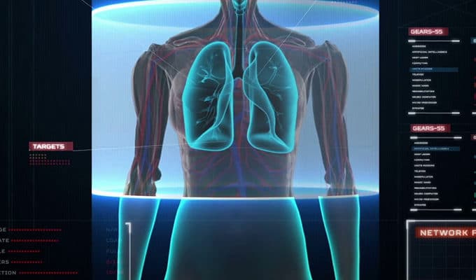 اسکن تمام بدن