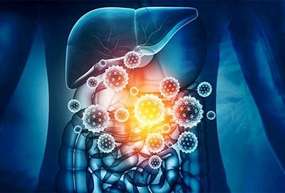 علل خونریزی دستگاه گوارش