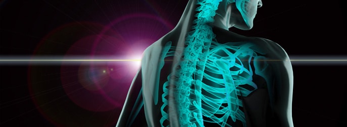 اسکن استخوان