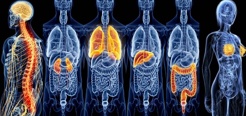 اسکن تمام بدن